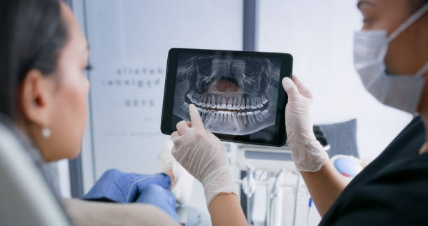 Licensed Tooth Extraction service in Olympia, WA - Smile Center Dentistry